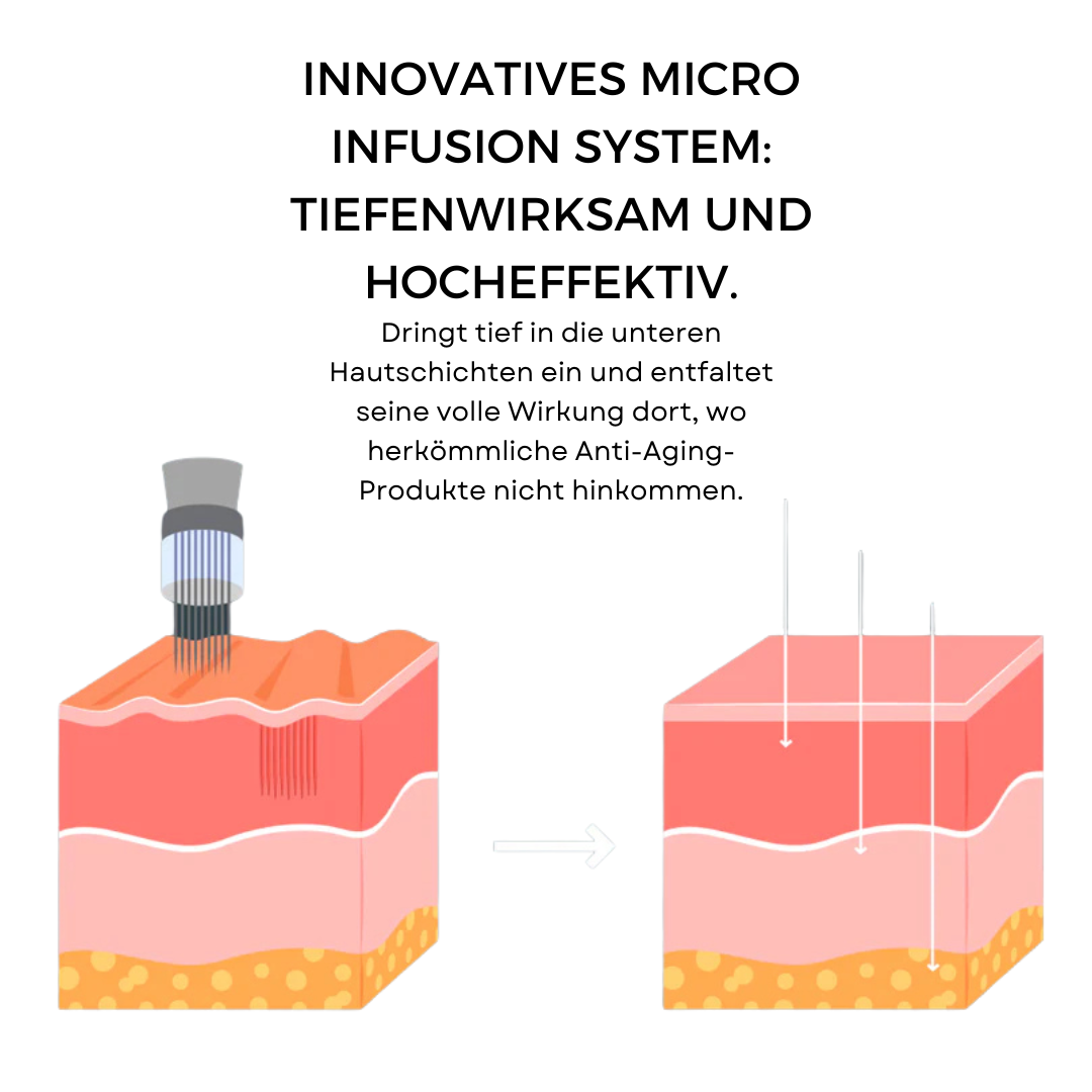 CelluNova Micro Infusion System™