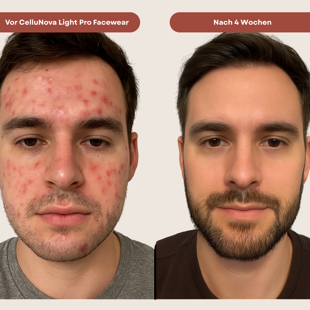 C-Light Pro Facewear