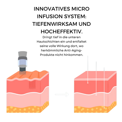 CelluNova Micro Infusion System™